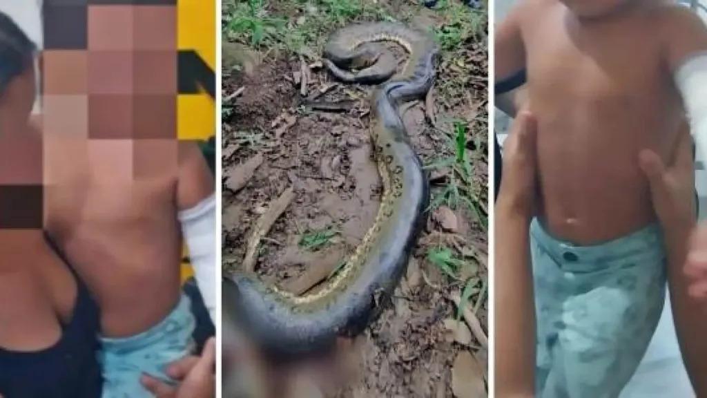 Criança de 2 anos é atacado por sucuri de 6 metros
