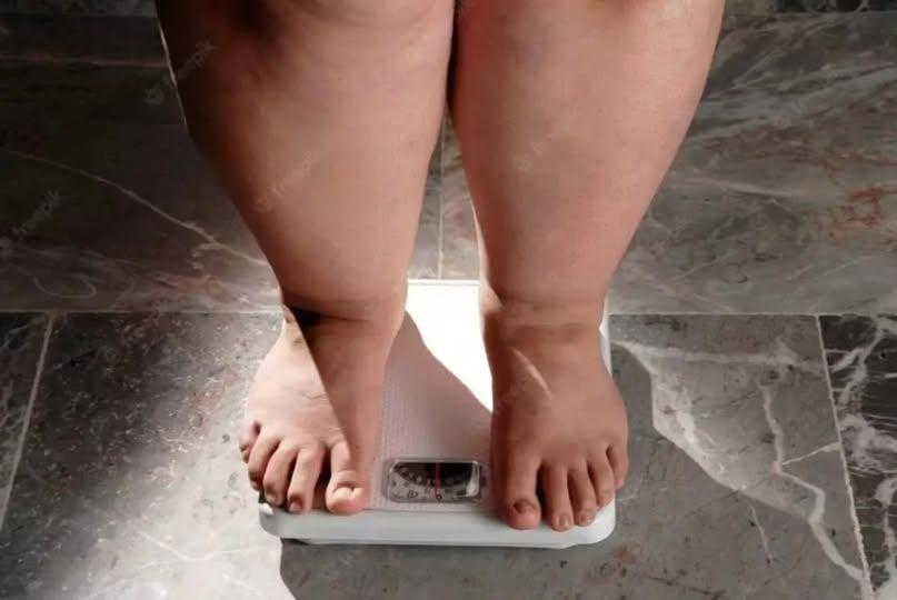 Três cidades gaúchas estão entre as dez do País com maior percentual de pessoas com obesidade