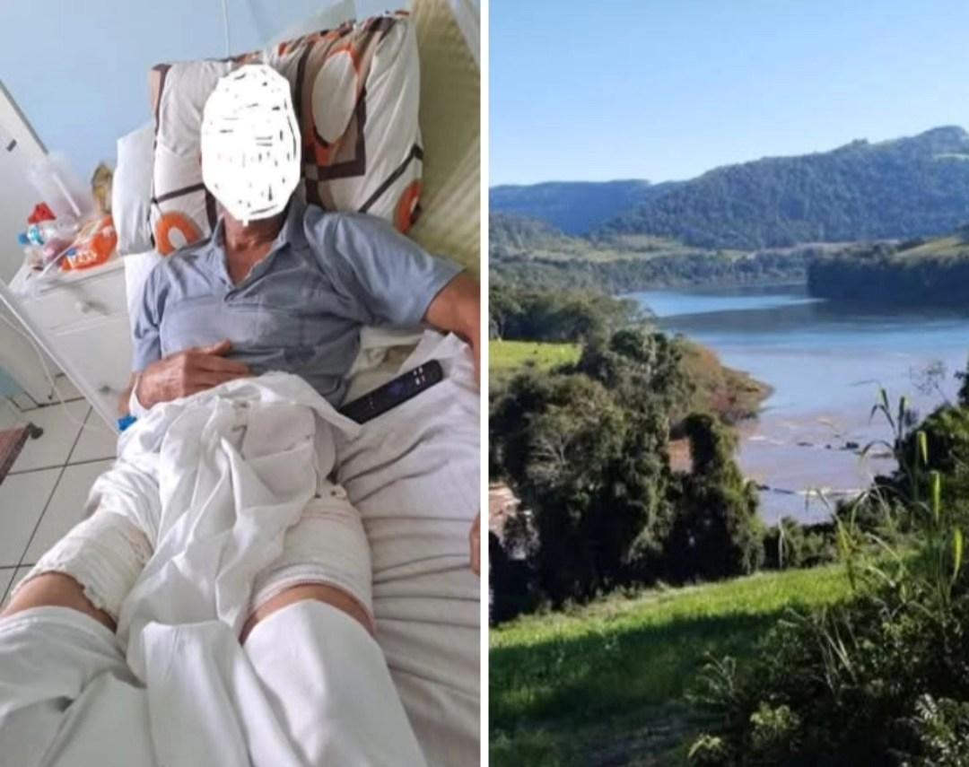 Pescador sofre ataque de animal no Rio Ligeiro em Maximiliano de Almeida,