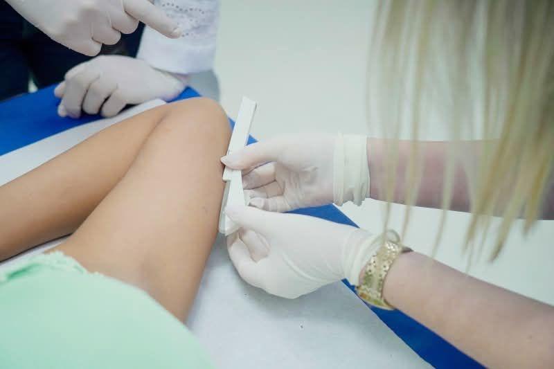 VACARIA PASSA A OFERTAR IMPLANON NA REDE PÚBLICA DE SAÚDE